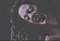 bite-me203.jpg